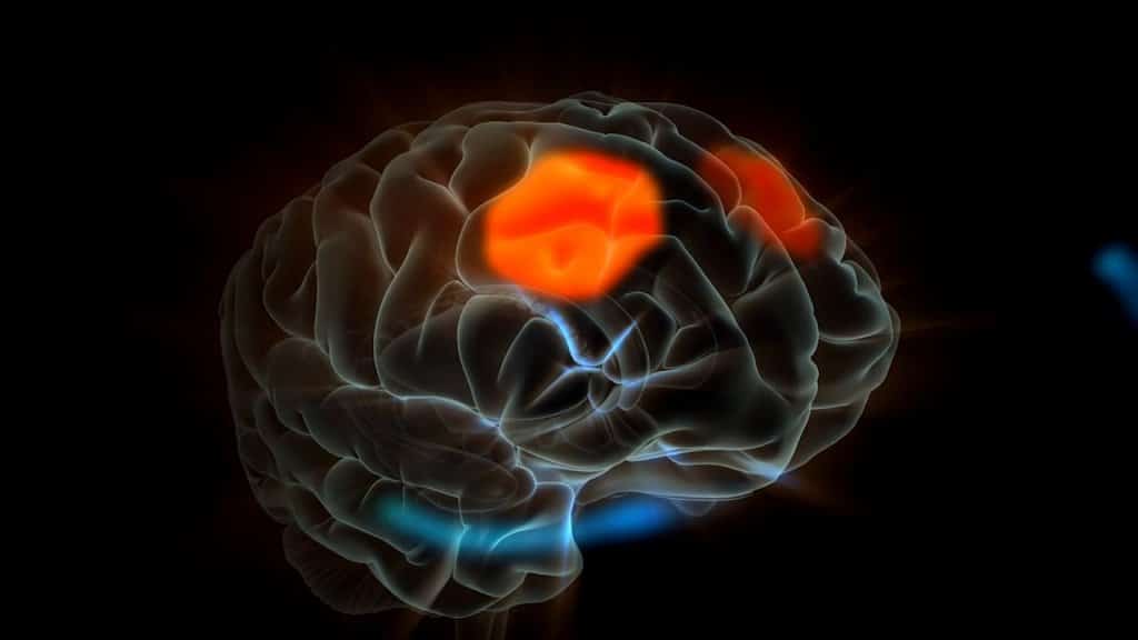 neurologist singapore
