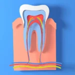 What Happens During Root Canal Treatment at a Private Dental Practice
