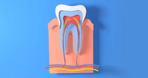 What Happens During Root Canal Treatment at a Private Dental Practice